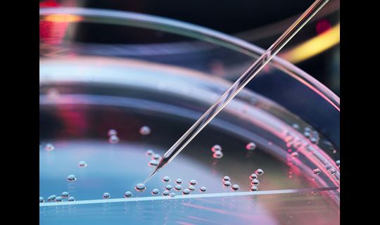 petri dish